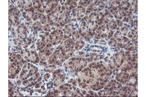 Image no. 8 for anti-Protein Phosphatase 1, Regulatory (Inhibitor) Subunit 15A (PPP1R15A) antibody (ABIN1498364)