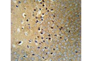 VHL antibody IHC analysis in formalin fixed and paraffin embedded mouse brain tissue.