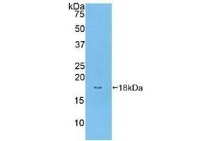 Detection of Recombinant BMPR2, Human using Polyclonal Antibody to Bone Morphogenetic Protein Receptor 2 (BMPR2)