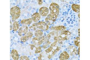Immunohistochemistry of paraffin-embedded Mouse kidney using KLHL42 Polyclonal Antibody at dilution of 1:100 (40x lens). (KLHDC5 anticorps)