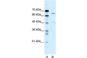 WB Suggested Anti-ACCN1 Antibody Titration:  0. (ACCN1 anticorps  (C-Term))
