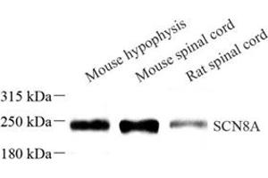 Western blot analysis of SCN8A (ABIN7075647),at dilution of 1: 600