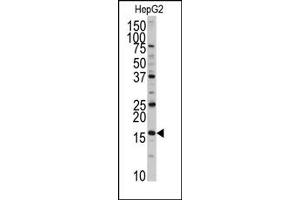 anti-DCTP Pyrophosphatase 1 (DCTPP1) (N-Term) antibody