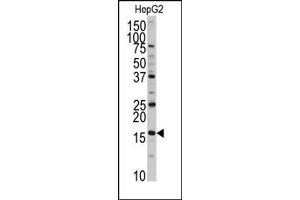 Image no. 1 for anti-DCTP Pyrophosphatase 1 (DCTPP1) (N-Term) antibody (ABIN357989) (DCTPP1 anticorps  (N-Term))