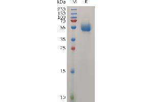 Human  IL31 Protein, hFc Tag on SDS-PAGE under reducing condition.