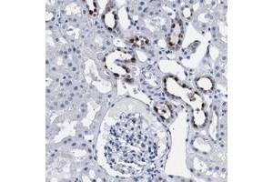 Immunohistochemical staining of human kidney with ATP6V0A4 polyclonal antibody  shows strong cytoplasmic positivity in cells in tubules at 1:50-1:200 dilution. (ATP6V0A4 anticorps)