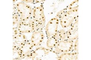 Immunohistochemistry of paraffin embedded rat kidney using PABPN1 (ABIN7075116) at dilution of 1:600 (400x lens) (PABPN1 anticorps)