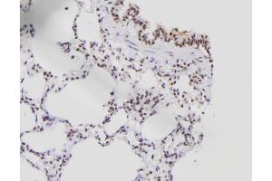 ABIN6261414 and ABIN6276538 at 1/100 staining Rat lung tissue by IHC-P. (E2F8 anticorps  (C-Term))