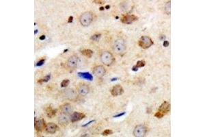 Immunohistochemical analysis of GABRG1 staining in human brain formalin fixed paraffin embedded tissue section. (GABRg1 anticorps  (N-Term))