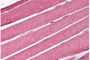 Human Skeletal Muscle (formalin-fixed, paraffin-embedded) stained with AICDA antibody ABIN214183 at 5 ug/ml followed by biotinylated goat anti-rabbit IgG secondary antibody ABIN481713, alkaline phosphatase-streptavidin and chromogen. (AICDA anticorps  (C-Term))