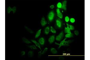 Immunofluorescence of monoclonal antibody to RPS6KB1 on HeLa cell.