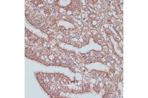 Immunohistochemistry of paraffin-embedded rat ovary using MOB4 antibody (ABIN6132926, ABIN6143935, ABIN6143936 and ABIN6220703) at dilution of 1:100 (40x lens). (MOBKL3 anticorps  (AA 1-225))