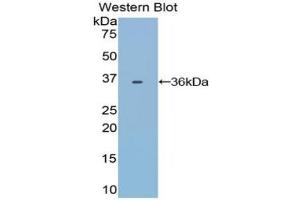 Detection of Recombinant TRF, Bovine using Polyclonal Antibody to Transferrin (TF)