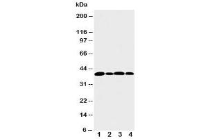 Western blot testing of Aurora B antibody and Lane 1:  rat liver (Aurora Kinase B anticorps  (N-Term))