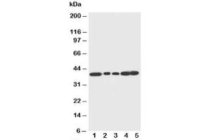 Western blot testing of Decorin antibody and Lane 1:  rat liver (Decorin anticorps  (C-Term))