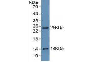 Rabbit Detection antibody from the kit in WB with Positive Control: Sample BXPC-3 cell lysate. (Trypsin Kit ELISA)