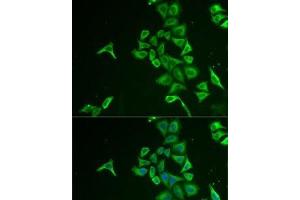 Immunofluorescence analysis of U2OS cells using INPP5J Polyclonal Antibody (INPP5J anticorps)
