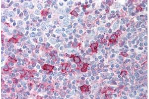 Human Tonsil (formalin-fixed, paraffin-embedded) stained with AKT1 antibody ABIN213755 at 5 ug/ml followed by biotinylated goat anti-rabbit IgG secondary antibody ABIN481713, alkaline phosphatase-streptavidin and chromogen. (AKT1 anticorps  (pSer473))