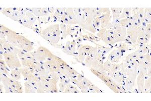 Detection of LRP6 in Human Cardiac Muscle Tissue using Polyclonal Antibody to Low Density Lipoprotein Receptor Related Protein 6 (LRP6)