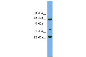 WB Suggested Anti-TRAPPC5 Antibody Titration: 0. (TRAPPC5 anticorps  (N-Term))