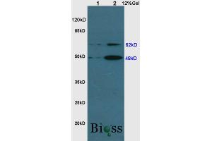 L1 rat kidney lysates, L2 rat brain lysates probed : Anti-GDF9 (ABIN682153) at 1:200 in 4 °C.