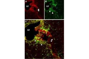 Expression of CNGA2 in mouse cerebrum - Immunohistochemical staining of mouse cerebrum using Anti-CNGA2 Antibody (ABIN7043090, ABIN7044955 and ABIN7044956). (CNGA2 anticorps  (Intracellular))