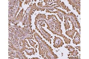 IHC analysis of YWHAE using anti-YWHAE antibody (ABIN7600163). (YWHAE anticorps  (AA 16-163))