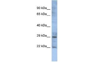 WB Suggested Anti-GJB1 Antibody Titration:  0. (GJB1 anticorps  (Middle Region))