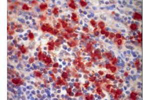 Image no. 1 for anti-S100 Calcium Binding Protein A9 (S100A9) antibody (ABIN379944) (S100A9 anticorps)