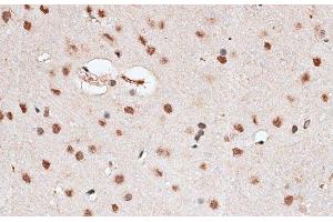 Immunohistochemistry of paraffin-embedded Rat brain using RBM3 Polyclonal Antibody at dilution of 1:100 (40x lens).