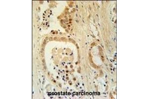 anti-Zinc Finger Protein 385B (ZNF385B) (AA 1-30) antibody