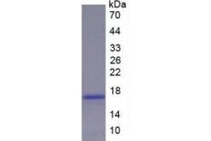 Rabbit Detection antibody from the kit in WB with Positive Control: Sample Rat Liver lysate. (Renin Kit ELISA)