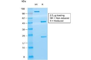SDS-PAGE Analysis of Purified CD8a Mouse Recombinant Monoclonal Antibody ABIN6383871. (Recombinant CD8 alpha anticorps)