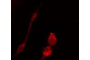 ABIN6274442 staining 293 cells by IF/ICC. (BRSK1 anticorps  (Internal Region))