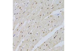 Immunohistochemistry of paraffin-embedded rat heart using SNRPA Antibody. (SNRPA1 anticorps  (AA 1-282))