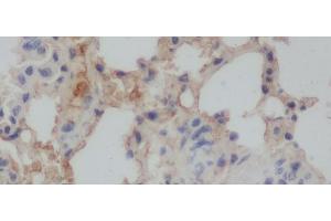 Immunohistochemistry of paraffin-embedded Rat lung using Aβ40 Polyclonal Antibody at dilution of 1:50 (Abeta 1-40 anticorps)