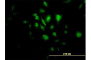 Immunofluorescence of monoclonal antibody to STK33 on HeLa cell. (STK33 anticorps  (AA 1-514))