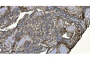 IHC analysis of MIEF1 using anti-MIEF1 antibody (ABIN7600396). (SMCR7L anticorps  (AA 189-463))