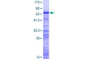 Image no. 1 for MKI67 FHA Domain-Interacting Nucleolar Phosphoprotein (MKI67IP) (AA 1-293) protein (GST tag) (ABIN1310967)