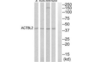 Western Blotting (WB) image for anti-Actin, beta-Like 2 (ACTBL2) (Internal Region) antibody (ABIN1852742) (ACTBL2 anticorps  (Internal Region))