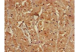 Immunohistochemistry of paraffin-embedded human heart tissue using ABIN7152346 at dilution of 1:100 (SULF2 anticorps  (AA 463-660))