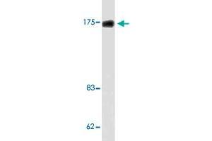 Western blot analysis of LoVo cell lysate with TOP2A polyclonal antibody . (Topoisomerase II alpha anticorps)