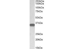 ABIN570905 (0. (CD20 anticorps  (C-Term))