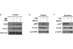 AKT cooperates with 14-3-3σ to facilitate nuclear translocation of TC45 in response to UVB irradiationWestern blot analysis of A.