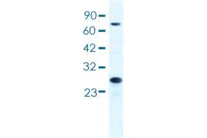 Western blot analysis of HepG2 cell lysate with MCM6 polyclonal antibody . (MCM6 anticorps  (AA 771-820))