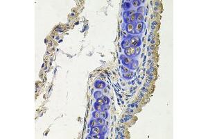 Immunohistochemistry of paraffin-embedded mouse lung using SKP1 antibody. (SKP1 anticorps  (AA 1-163))