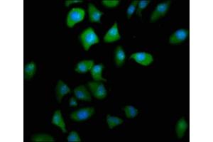 Immunofluorescence staining of A549 cells with ABIN7164870 at 1:166, counter-stained with DAPI.