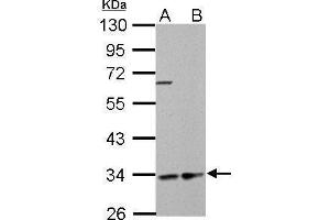 WB Image HADH antibody detects HADH protein by Western blot analysis. (HADH anticorps)