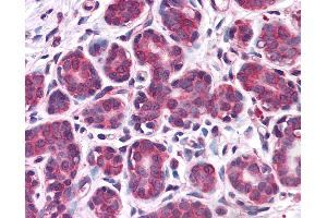 Anti-RBBP8 / CTIP antibody IHC of human breast. (Retinoblastoma Binding Protein 8 anticorps  (AA 452-747))
