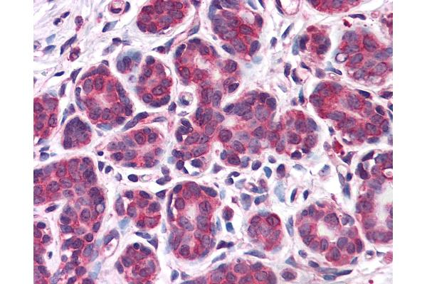 Retinoblastoma Binding Protein 8 anticorps  (AA 452-747)